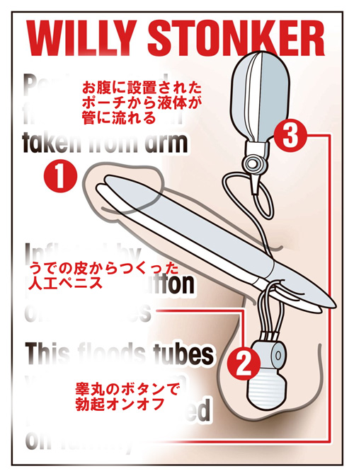 チンコは再生できる 勃 もできる Blニュース ちるちる